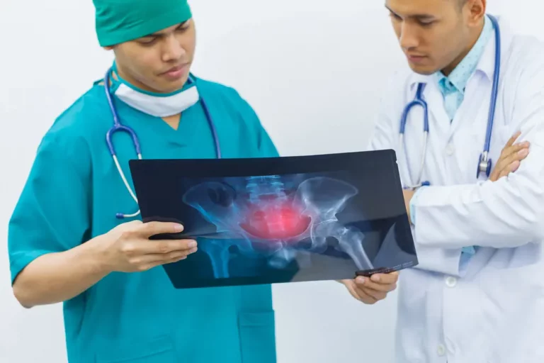 Two doctors are diagnosing the symptoms of a patient from x-ray at hip bone - bone cancer symptoms concept