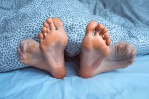 Woman suffering from Restless legs syndrome