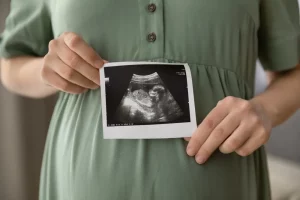 young pregnant female holding sonogram picture of unborn baby inside her big belly - 9 month of pregnancy concept